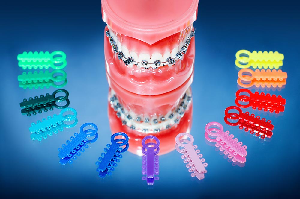 best-orthodontist-bucks-county-pa-braces-dentist