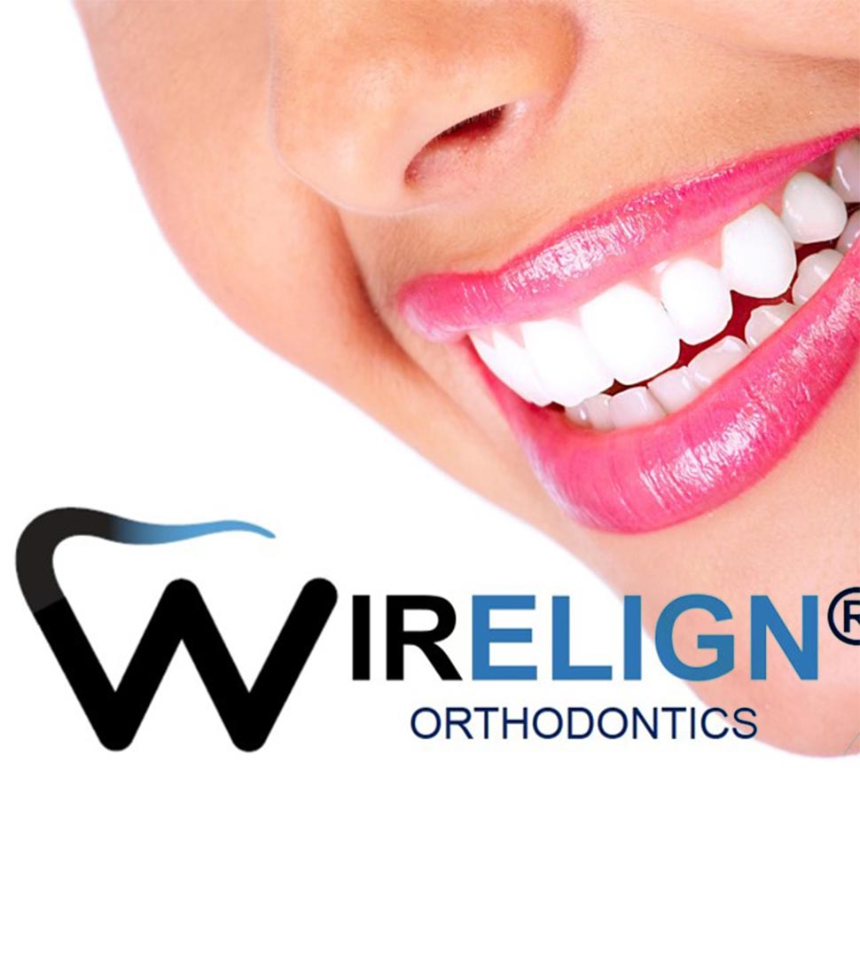 orthodontist-buckingham-pa-invisalign-clear-braces