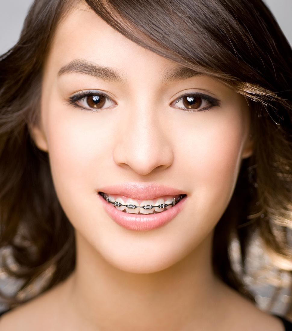 orthodontist-chalfont-pa-traditional-braces-ottsville